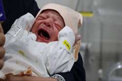 جگرگوشه پیوند کبد گیلان متولد شد